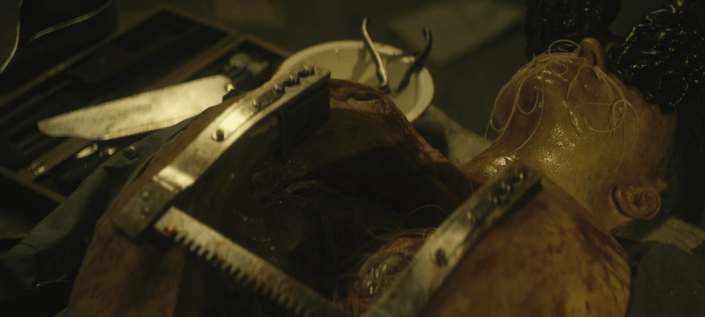 Trench 11 - Parasite